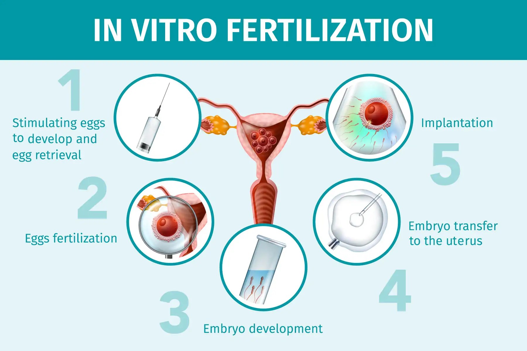 체외수정(IVF) 주기에 대한 단계별 과정 안내