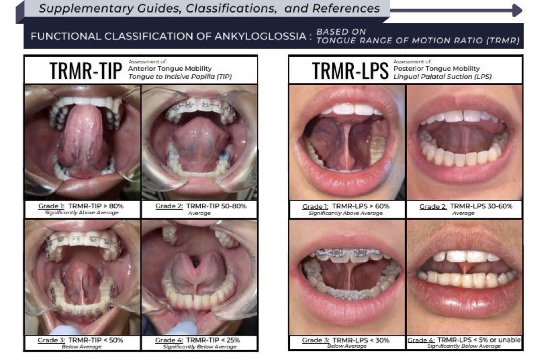 Myofunctional Therapy near Dallas, TX TMJ Plus Wellness