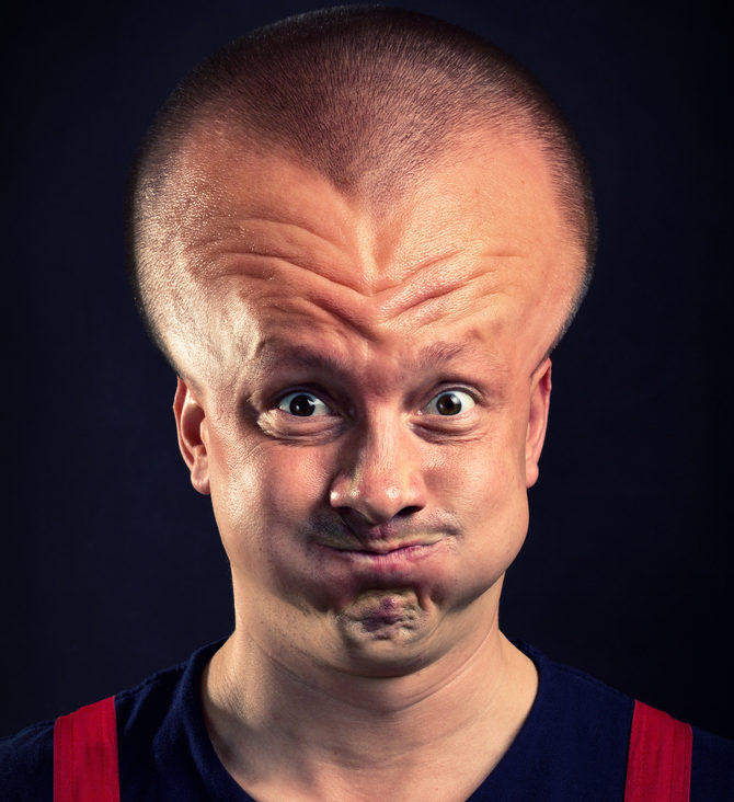 Exploding Head Syndrome