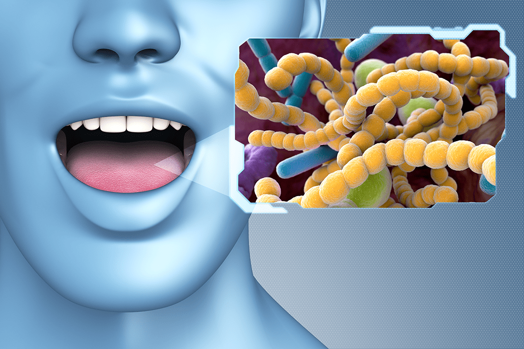 Are you a “Pro”biotic of the oral microbiome? Today's RDH