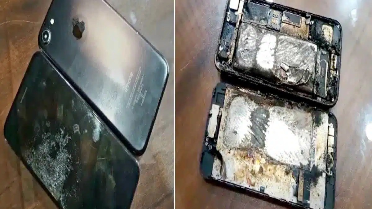 Son iPhone explose et prend feu dans sa poche, il finit à l’hôpital