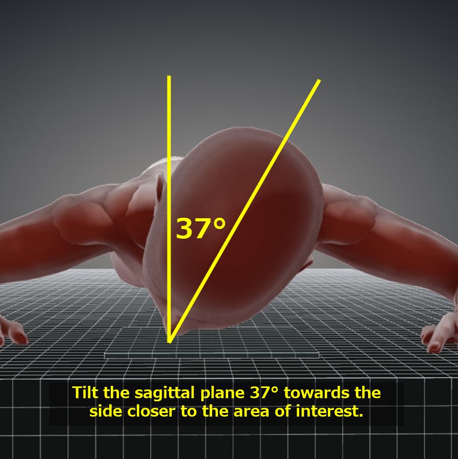 RheseGoalwin view, Optic foramina parietoorbital projection｜Tools for