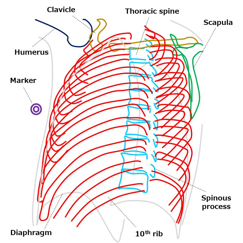 Ribs oblique view, Axillary ribs｜Tools for RadTech