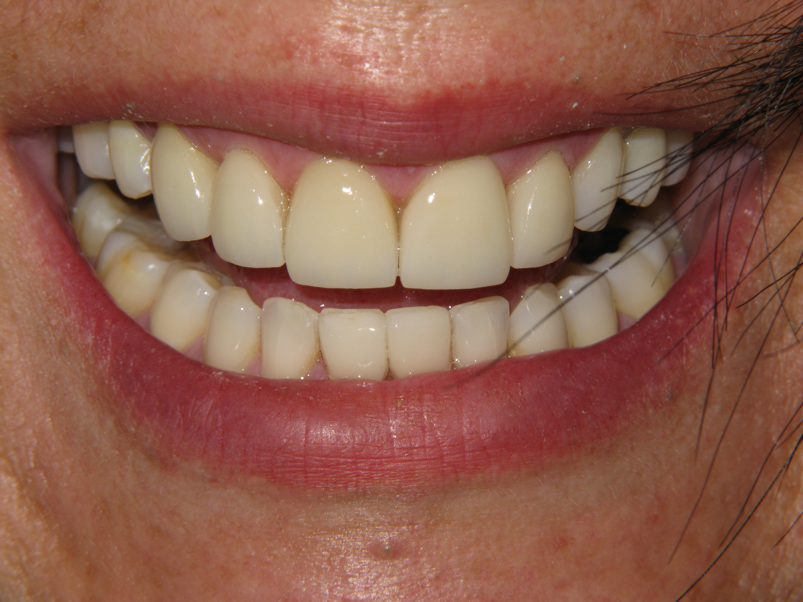 Smile Gallery Dentist Fountain Valley, CA Bijan Family Dental Practice