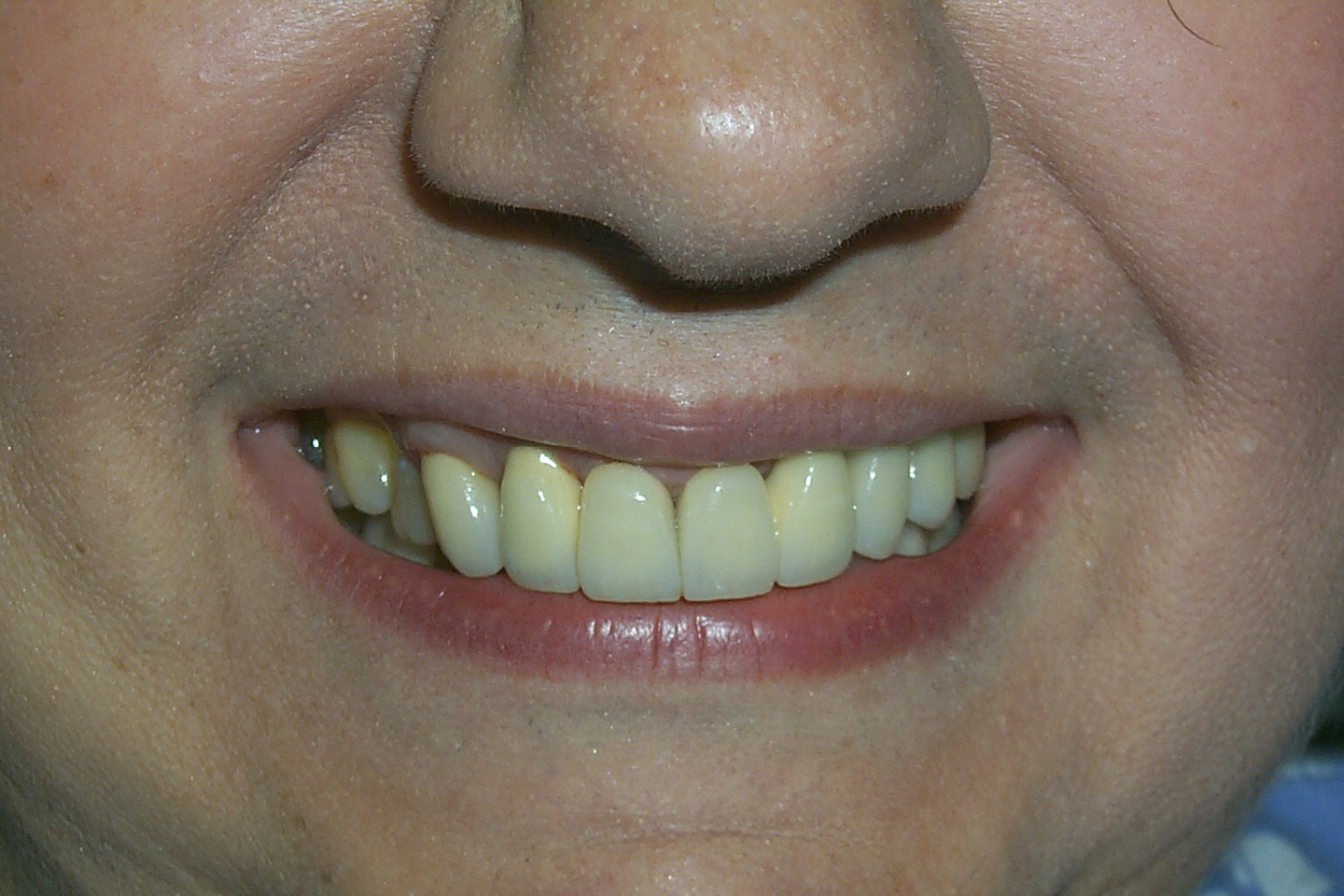 Smile Gallery Dentist Fountain Valley, CA Bijan Family Dental Practice