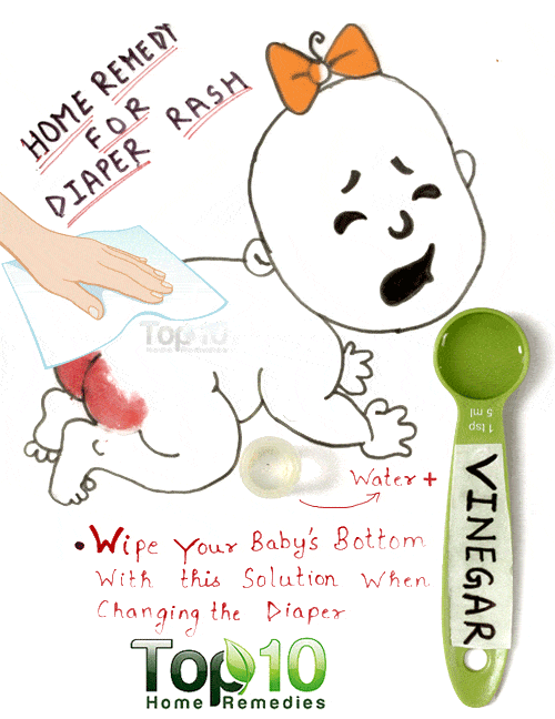 Home Remedies for Diaper Rash Top 10 Home Remedies