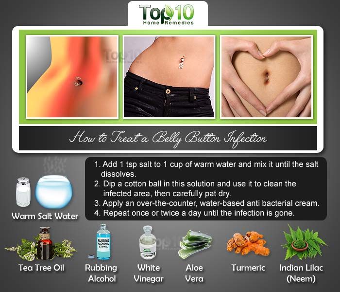 How to Treat a Belly Button Infection Top 10 Home Remedies