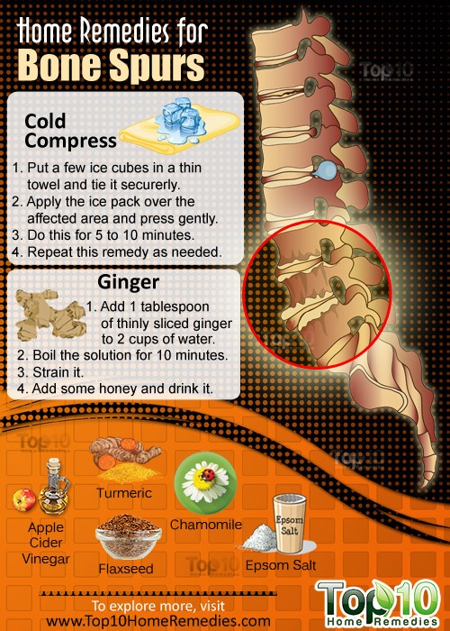 Home Remedies for Bone Spurs Top 10 Home Remedies