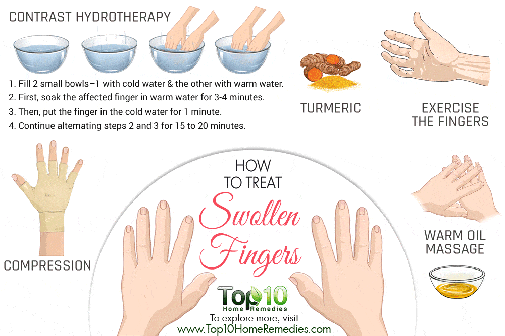 How to Treat Swollen Fingers Top 10 Home Remedies