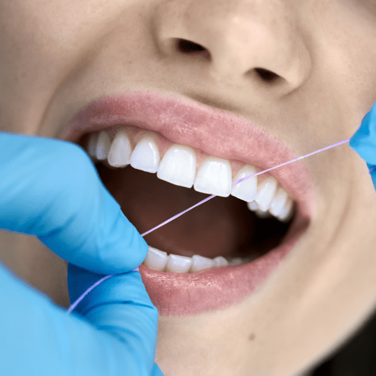 Dentist in Topeka, Kansas 4 Benefits of Dental Cleanings