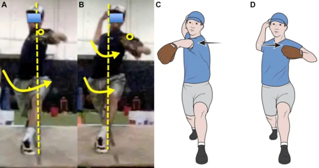Why Does My Elbow Hurt After Pitching? TopVelocity