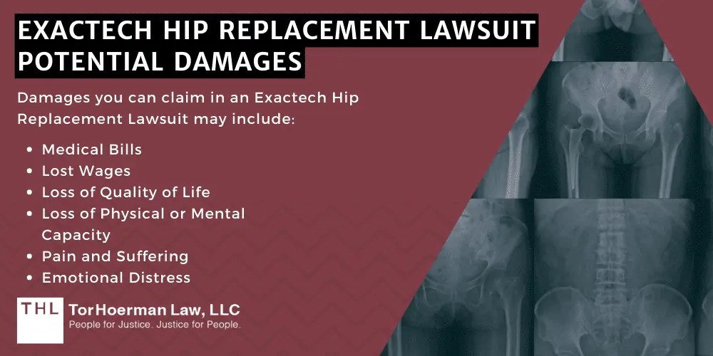 Exactech Hip Replacement Recall Lawsuit