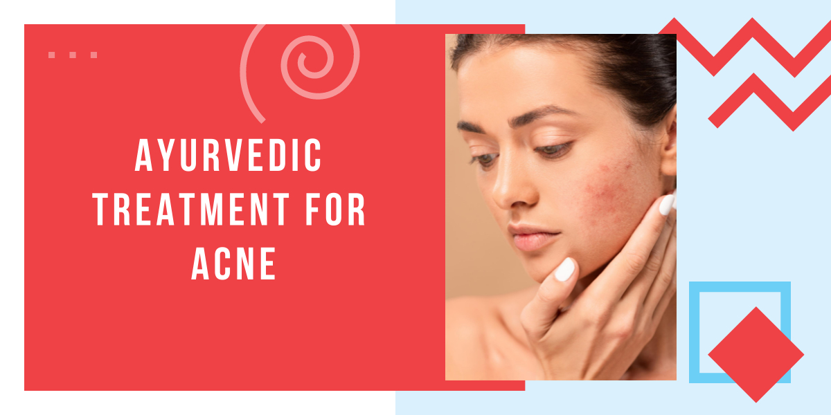 Ayurvedic Treatment For Acne Causes, Symptoms And Treatment Of Acne