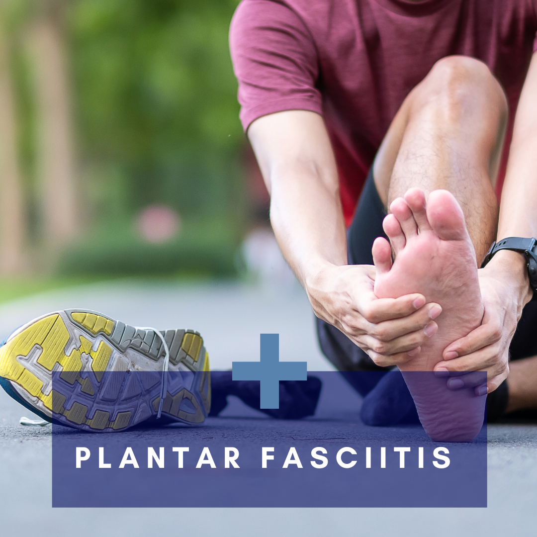 What is Plantar Fasciitis? Total Physio Manly Vale
