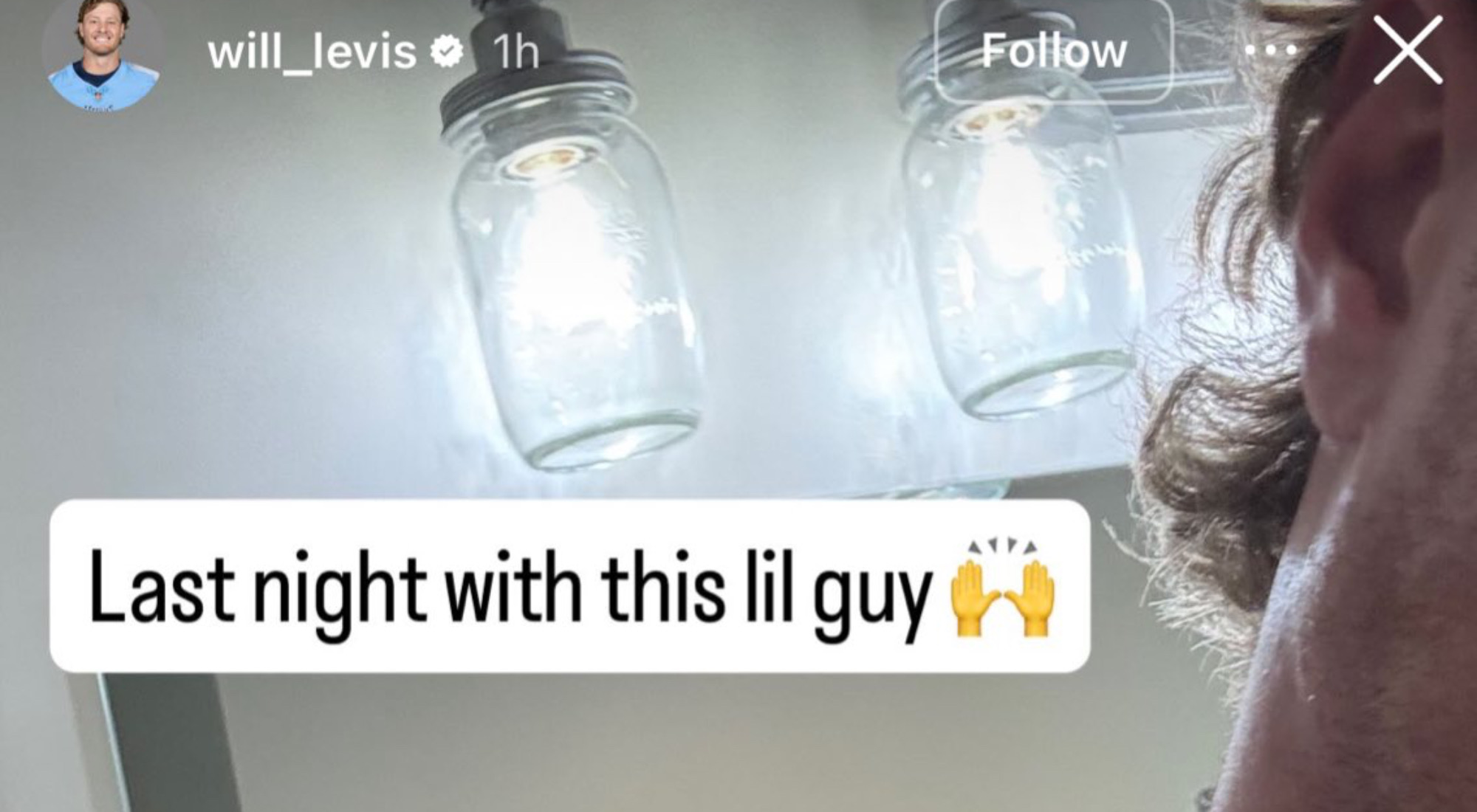 Titans QB Will Levis Shows Off Gruesome Photo Of His Gnarly Season
