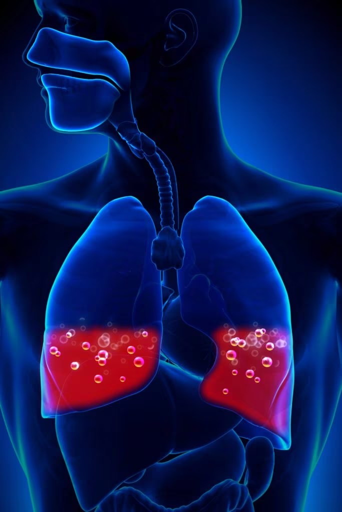 Pulmonary embolism which patients should receive thrombolytic therapy
