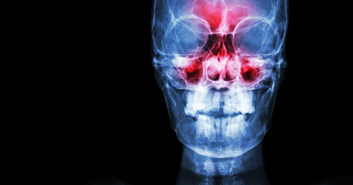 CT Scan Offers Better Sinusitis Treatment • Touchstone Medical Imaging