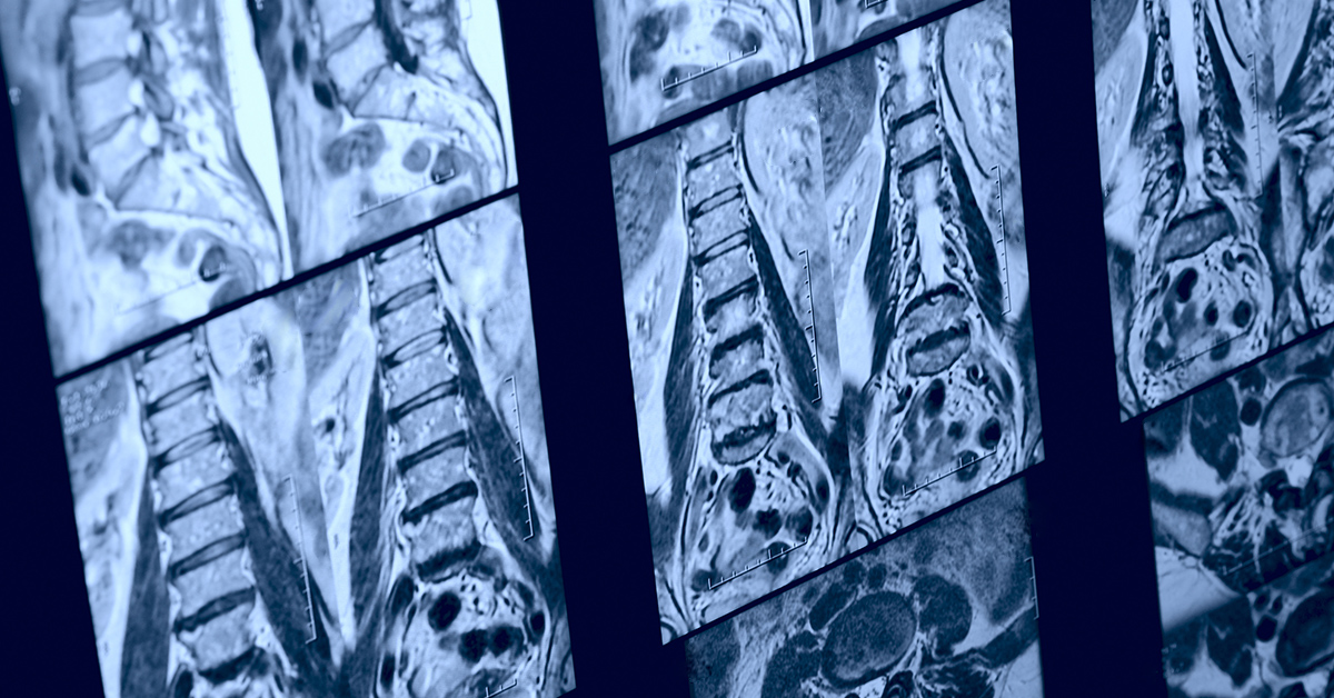 MRI for Back Pain—See What’s Inside • Touchstone Medical Imaging