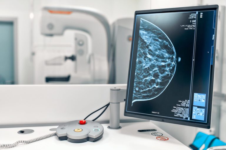 3D Screening Mammography • Touchstone Medical Imaging