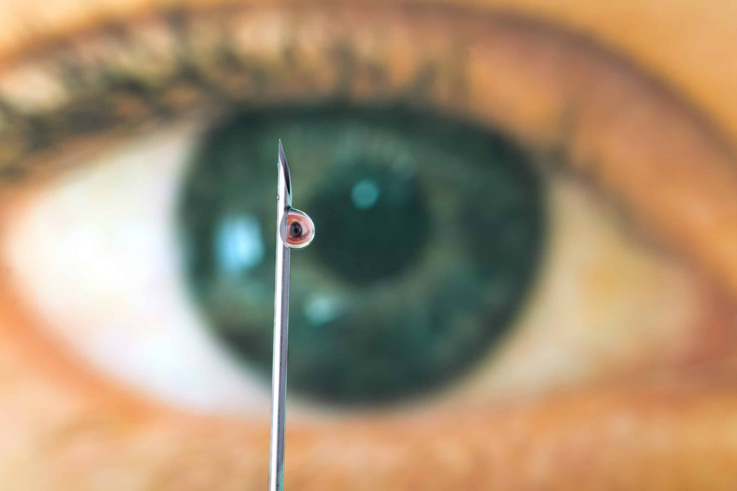 Intravitreal injections What to expect Tower Clock Eye Center