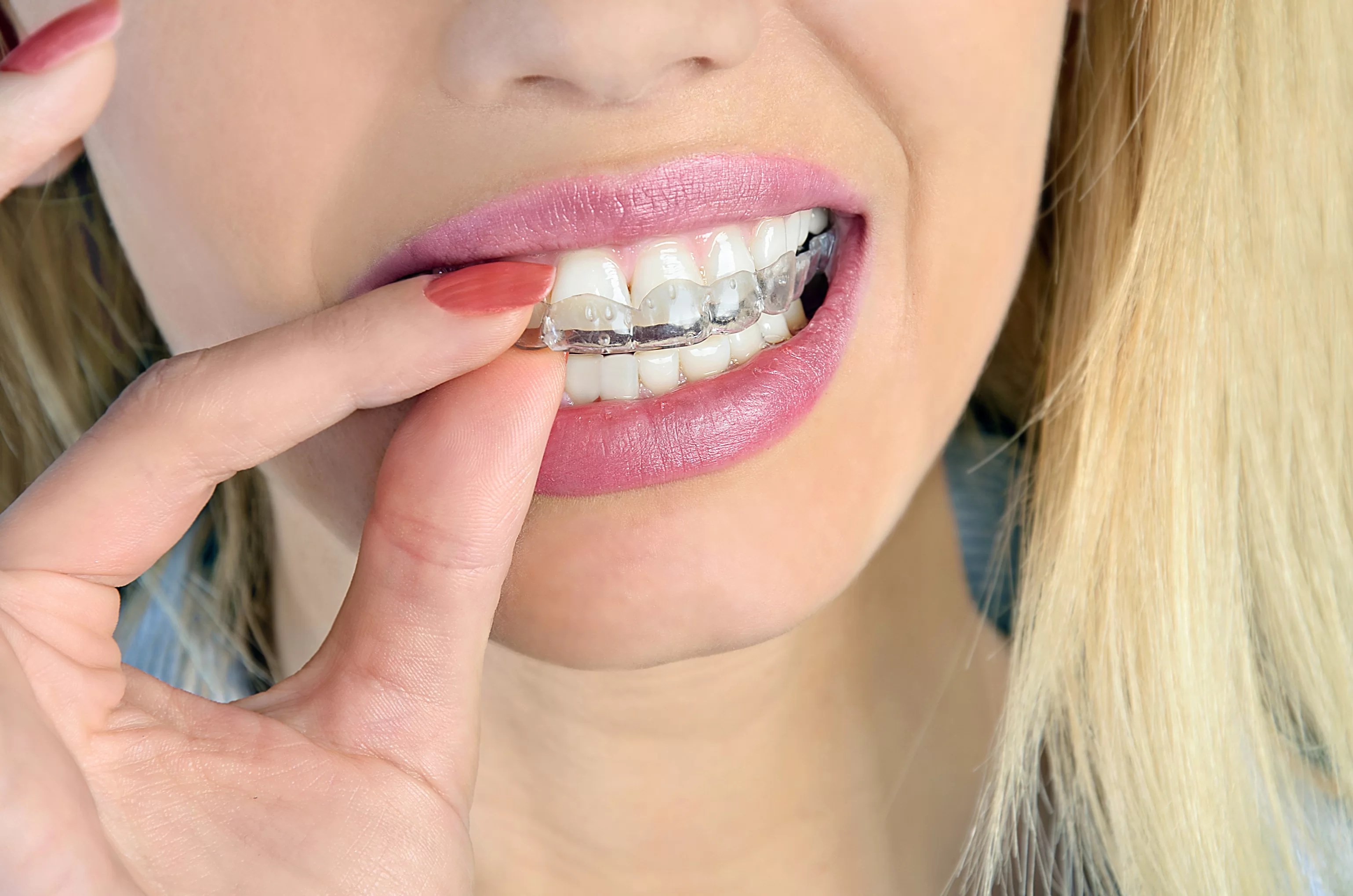 19 Habits That Hurt Your Teeth Traceybell Liverpool & Isle of Man