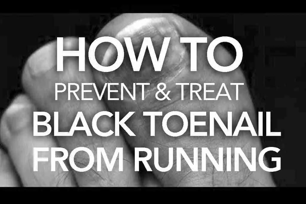 How to Prevent and Treat Black Toenail from Running Train for a