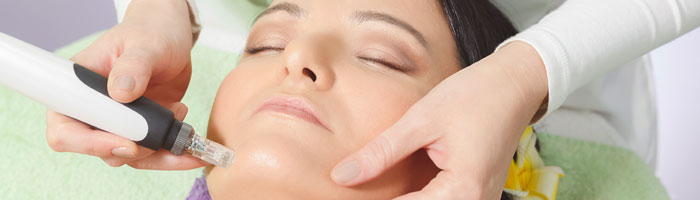 Microneedling Tranquility Spa Scarsdale