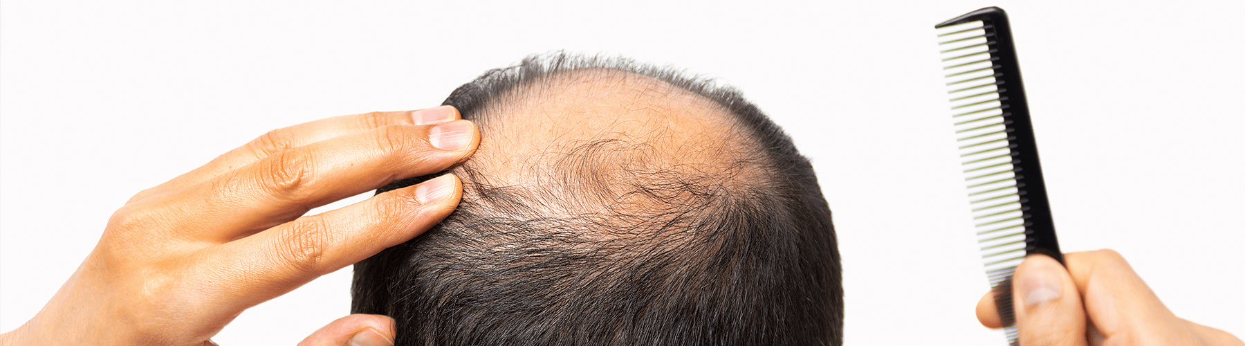 Peptide PTDDBM for Hair Loss