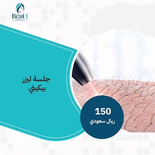 Laser hair removal session for bikini