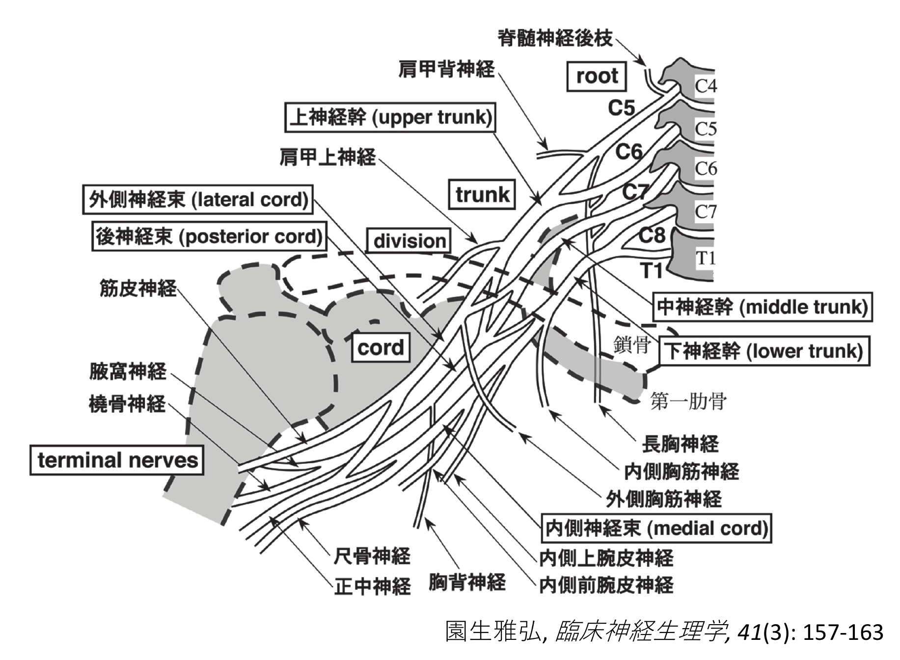 Brachial plexopathy（BP）：腕神経叢障害