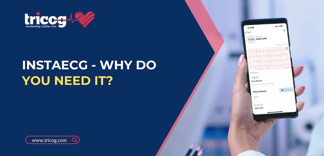 Tricog InstaECG (Why Do You Need It?)