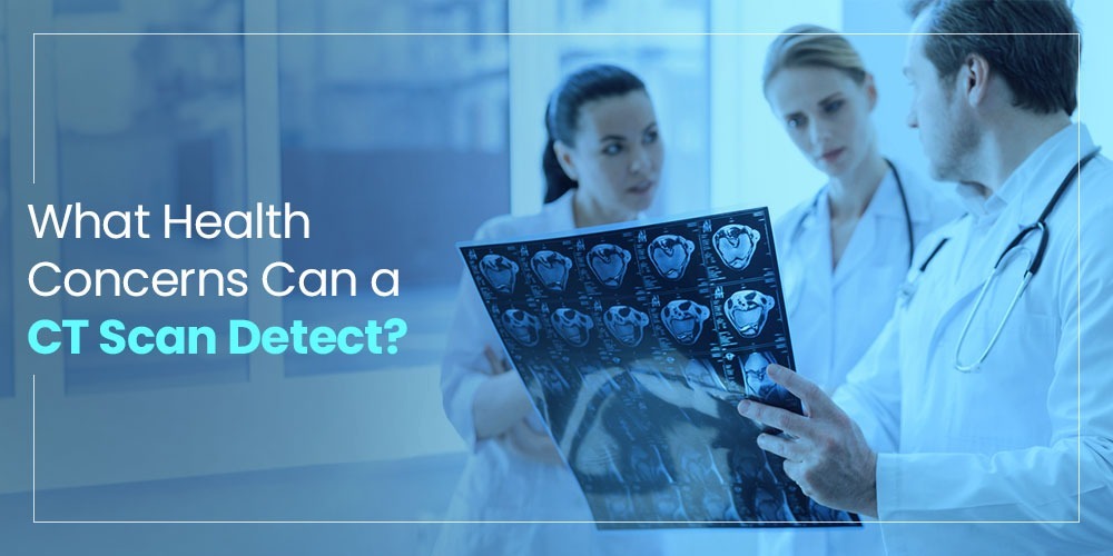 What Does a CT Scan Detect? Blockages, Tumors, Injuries & More