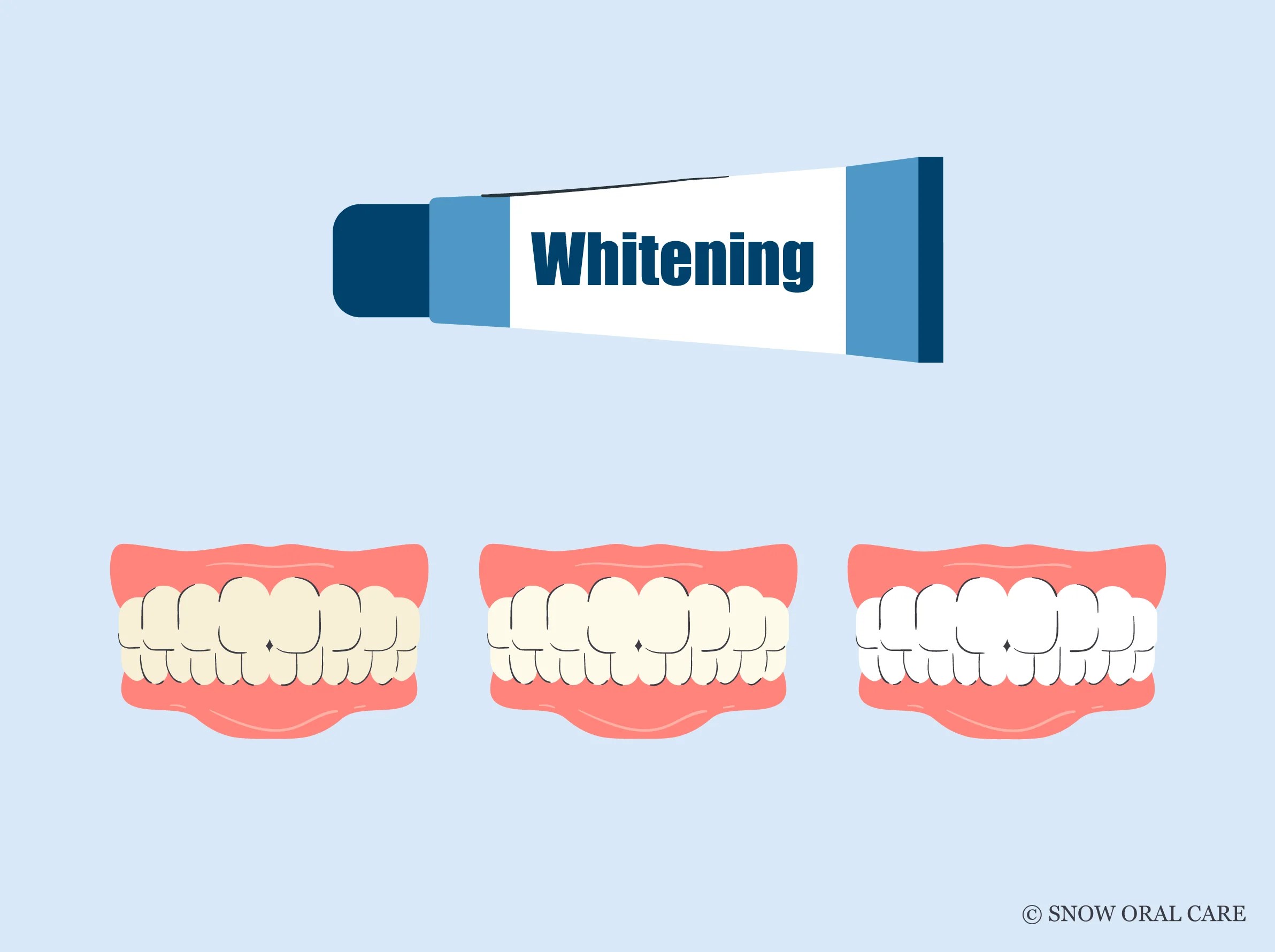 Does Whitening Toothpaste Work | SNOW® Oral Care
