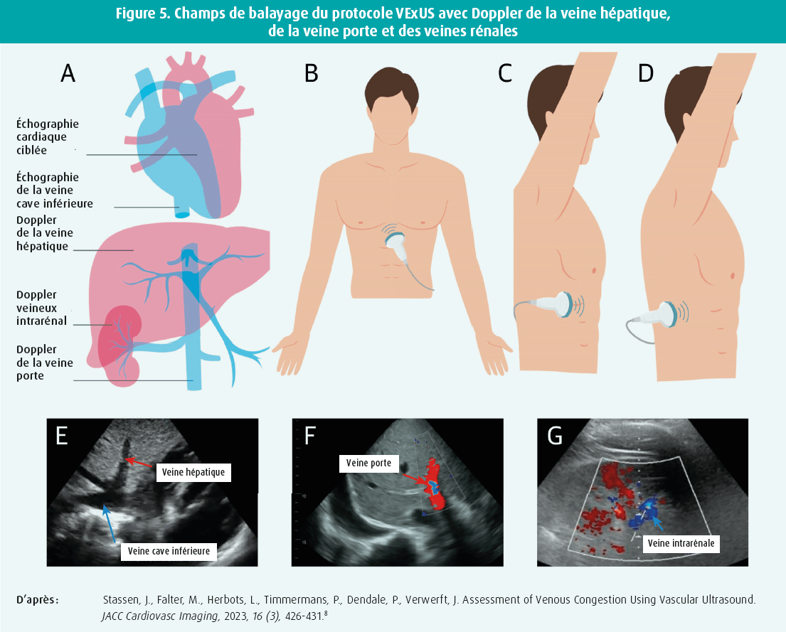 L'écho(cardio)graphie au chevet du patient en soins aigus Journal de