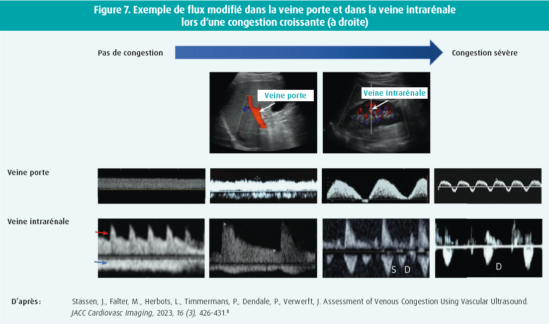 L'écho(cardio)graphie au chevet du patient en soins aigus Journal de