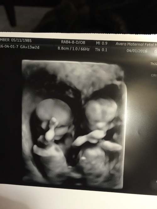 13 Weeks Pregnant with Twins Tips, Advice & How to Prep Twiniversity