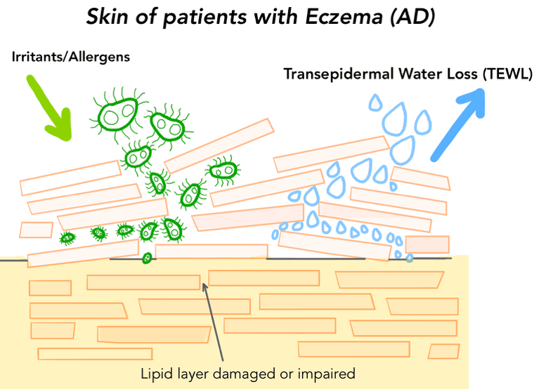 Best Eczema Management Allin1 MultiCERAM Moisturiser TWL
