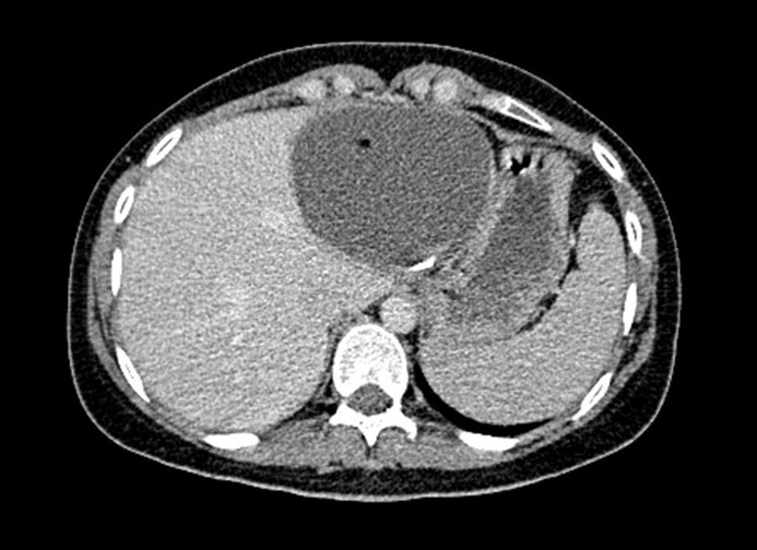 What are Chest or Thorax CT scans? Two Views