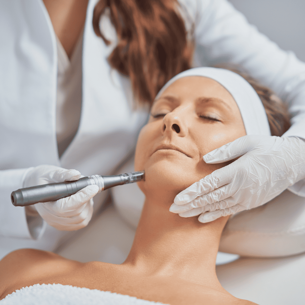 Microneedling Twoth Dental + Facial Aesthetics