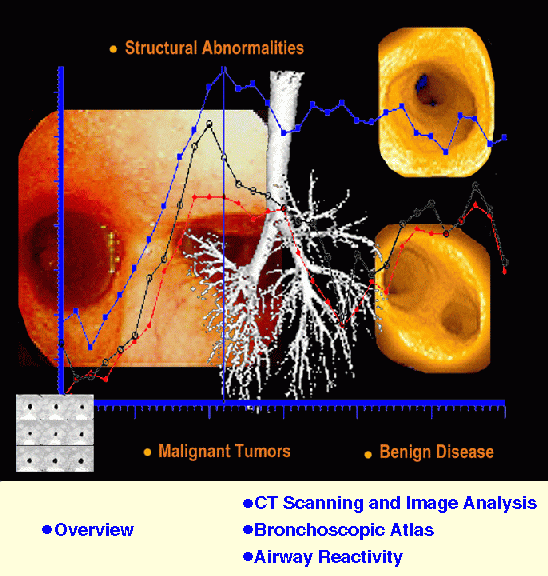 BRONCHOSCOPY