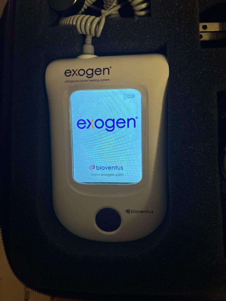 Exogen Ultrasound Bone Healing System Universal Machinery Inc