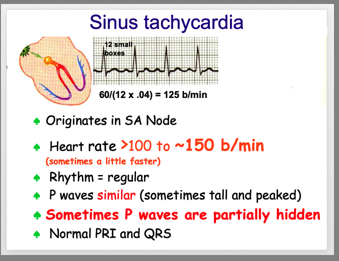 Sinus Rhythms