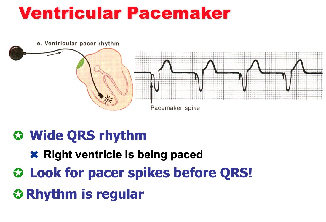 Pacemaker Rhythms