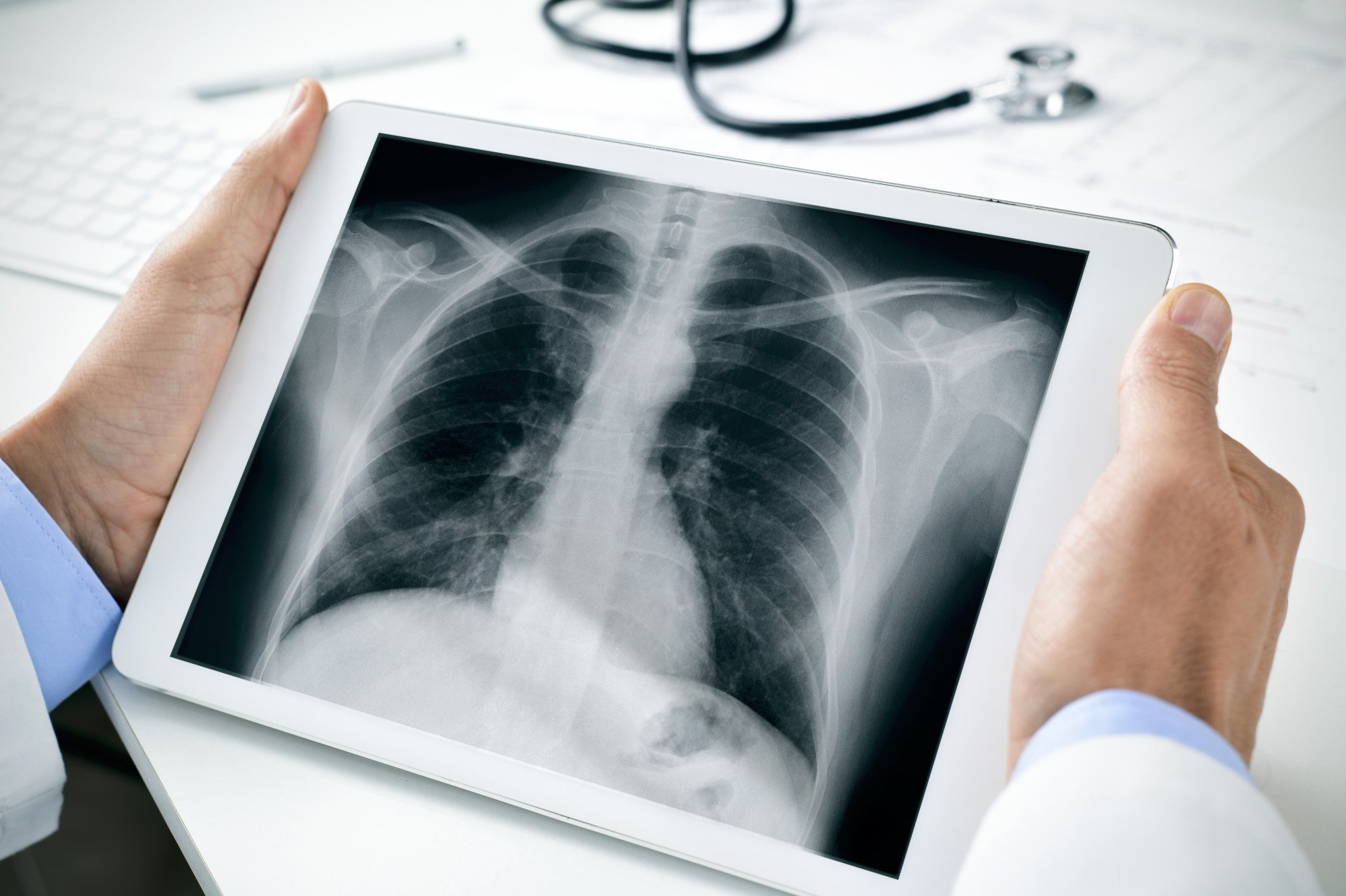 The Benefits of Digital XRays
