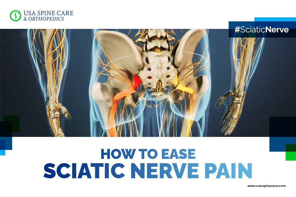 How to Ease Sciatic Nerve Pain USA Spine Care Laser Spine Surgery
