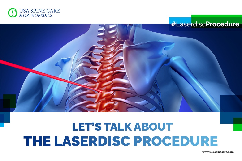 Let’s Talk About Laser Disc Procedures USA Spine Care