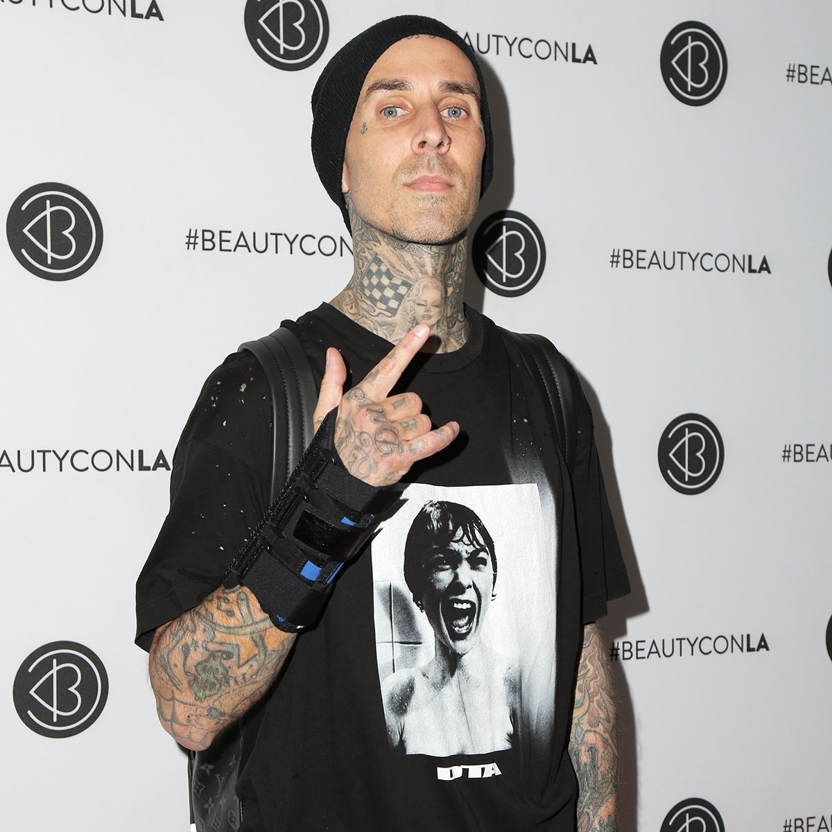 Travis Barker Shares Health Update Following Car Accident, Blood Clots