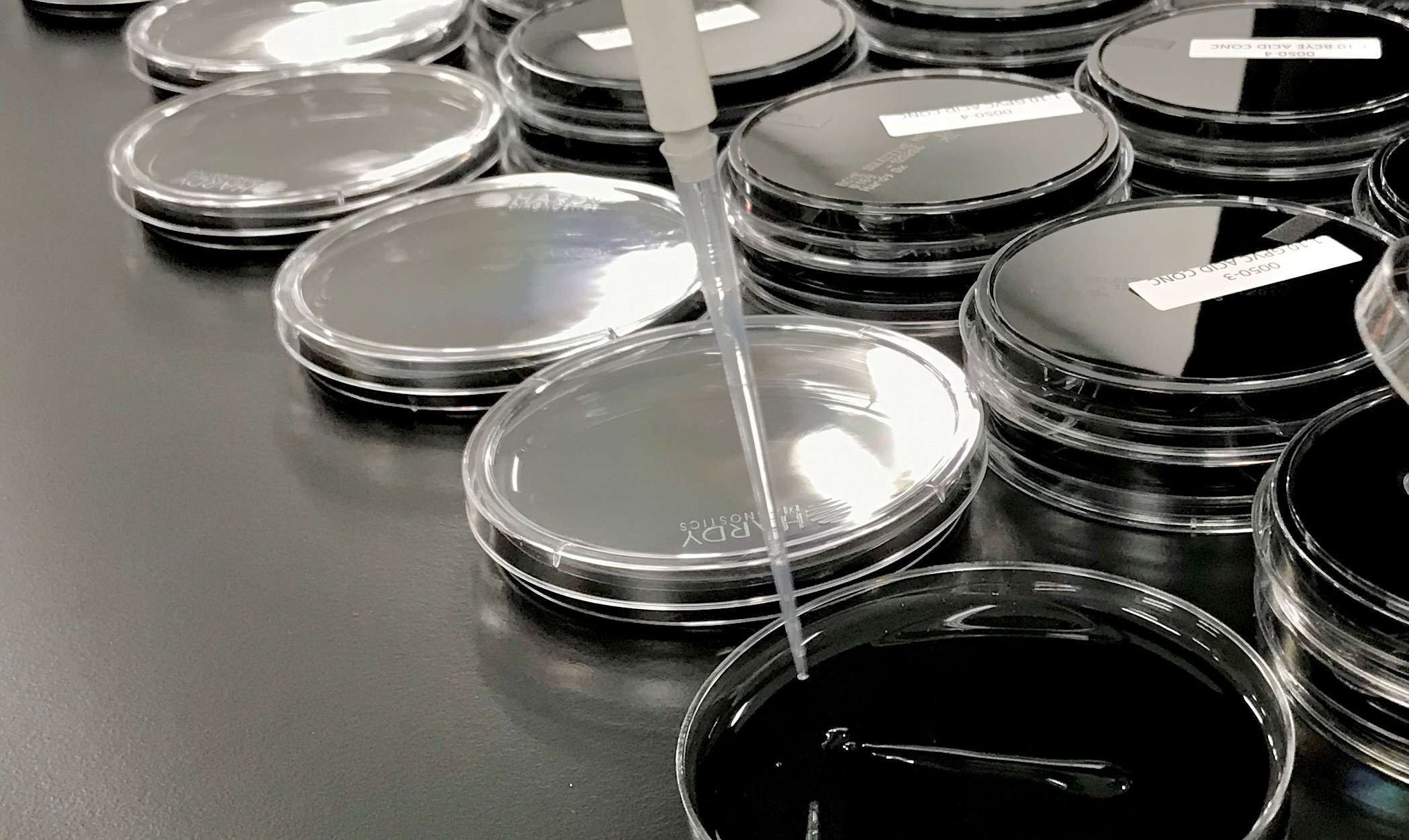 Hot Tubs, Spas, and Legionnaires’ Disease U.S. MicroSolutions