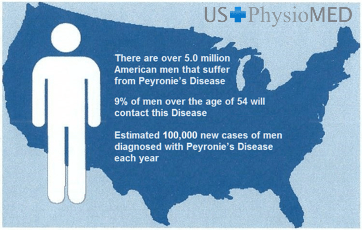 Traction Therapy for Peyronie's Disease TreatmentUSPhysioMED