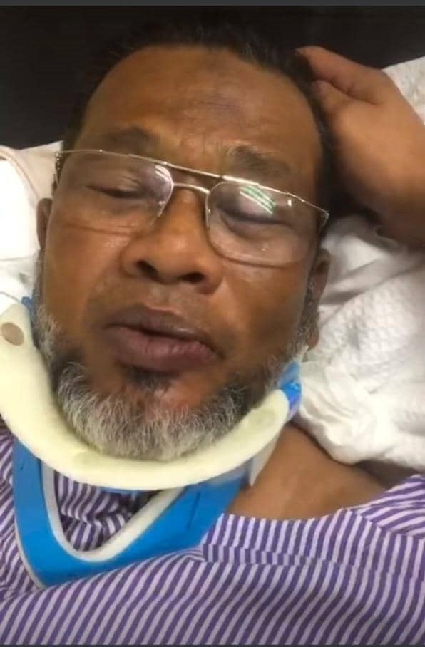 Nash stabil, sakit belakang dan mulut dijahit selepas